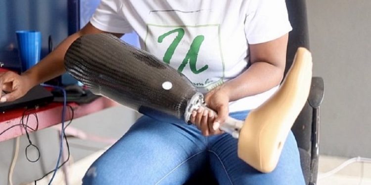 Afrique du Sud: des prothèses low-cost imprimées en 3D